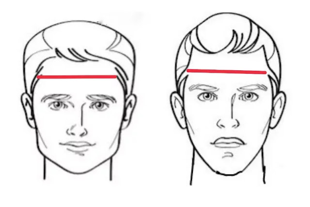 Shown the way of measuring forehead